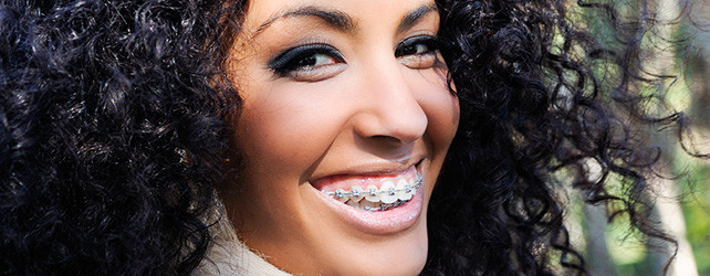 Ask Your New Caney Dentist: Should I Get Metal or Clear Braces?